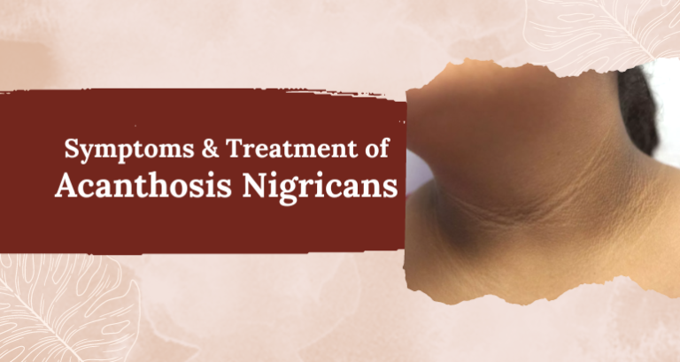 What Are The Symptoms And Treatment Of Acanthosis Nigricans