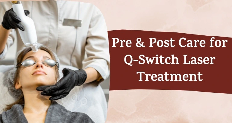 Pre and post care for Q switch laser treatment
