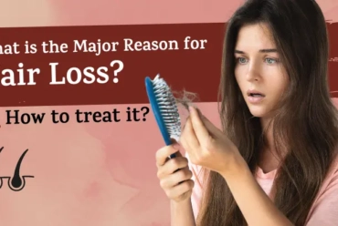 Hair Loss Causes and Solutions for Men and Women